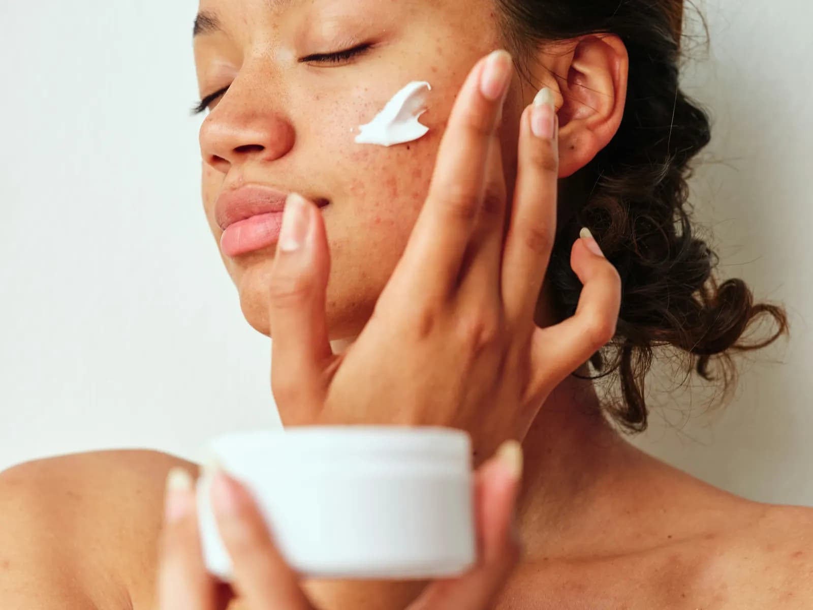 Une femme applique une crème sur une peau à imperfections